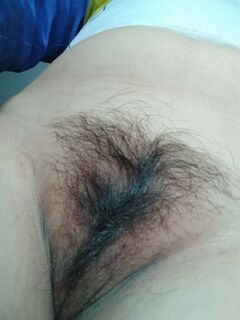 Mbbg