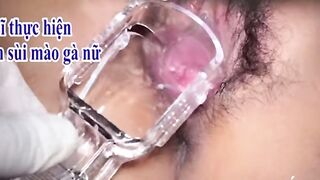 Cận cảnh khám phụ khoa nữ vn u45