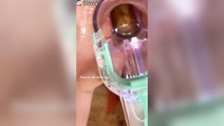 Đái vào lỗ đít em người yêu dâm đãng: Xem thêm trong phần mô tả