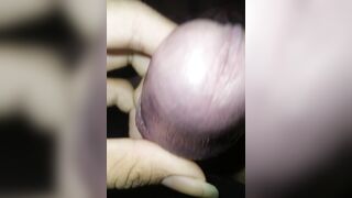Cột con cặc lại bằng dây kẽm trong 9h và nó tím tái