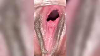 Khám phố bên trong tử cung của cái lồn rộng