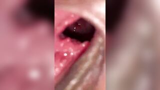 Khám phố bên trong tử cung của cái lồn rộng