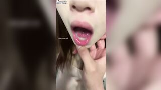 ...... 171