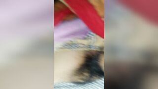 part2 niệu đạo