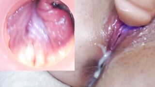 Sex toy gắn cam xem bên trong lồn đầy dâm thủy trắng xoá