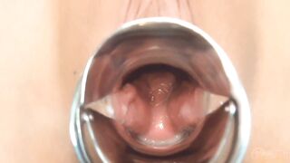 Cái lồn gái bầu lồn đầy tinh trùng hồng hào