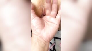 em loli thông niệu đạo 1