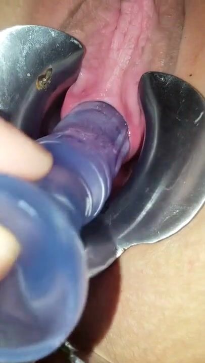 Thủ dâm lỗ đái