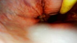 AMAZING INTERNAL POV. CAMERA INSIDE HER PUSSY WHILE I FILL HER WITH CUM